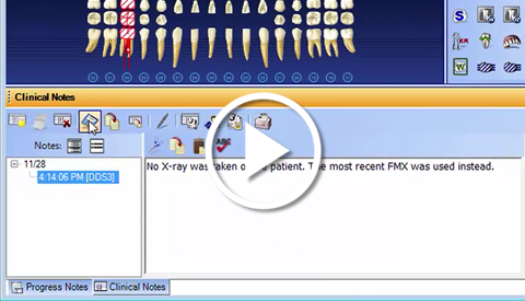 Clinical Note Computer Patient Chart Videos