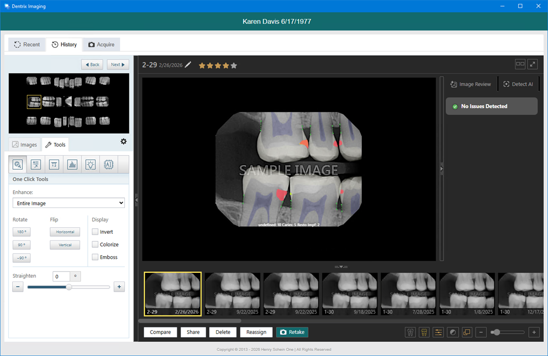 Acquiring images of selected teeth