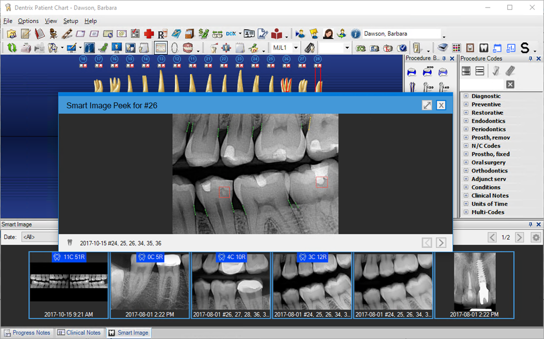 Accessing Dentrix Detect AI images from the Patient Chart